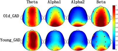 Difference analysis of multidimensional electroencephalogram characteristics between young and old patients with generalized anxiety disorder